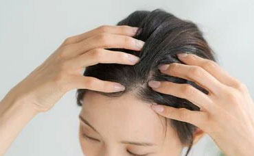 女性の薄毛「FAGA」に効果的な治療法